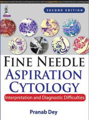 Fine Needle Aspiration Cytology: Interpretation and Diagnostic Difficulties by Pranab Dey