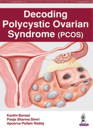 Decoding Polycystic Ovarian Syndrome (PCOS) by Kanthi Bansal