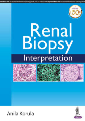 Renal Biopsy Interpretation by Anila Korula