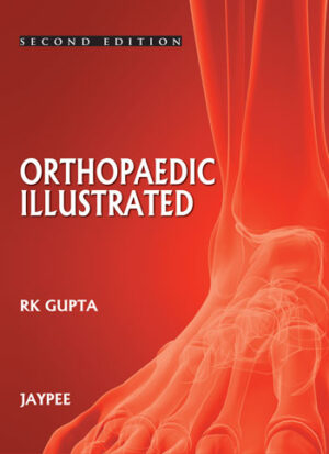 Orthopedics Illustrated by RK Gupta