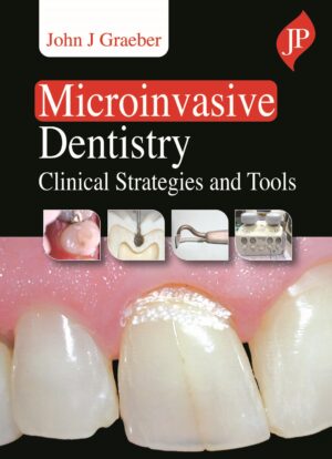 Microinvasive Dentistry: Clinical Strategies and Tools by John J Graeber