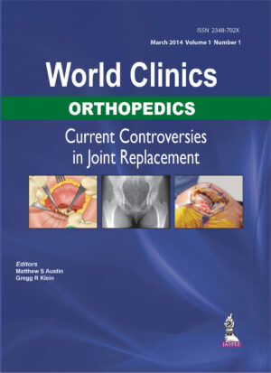 World Clinics Orthopedics : Current Controversies in Joint Replacement by Matthew S Austin