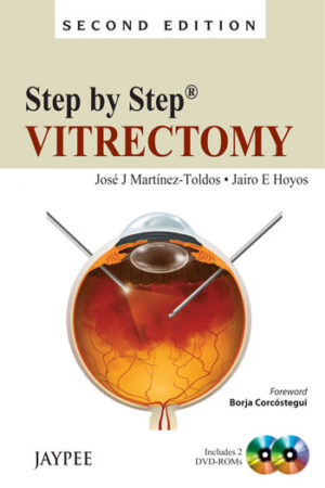 Step by Step Vitrectomy by Jairo E Hoyos