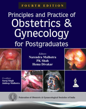 Principles and Practice of Obstetrics and Gynecology for Postgraduates by Narendra Malhotra