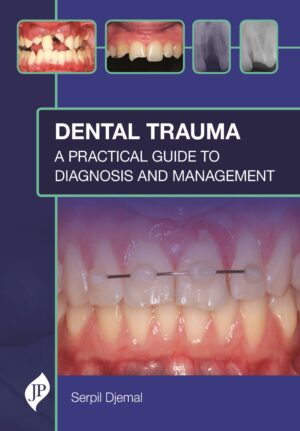 Dental Trauma: A Practical Guide to Diagnosis and Management by Serpil Djemal