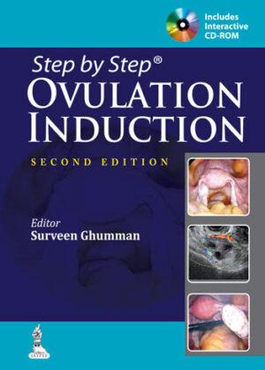 Step by Step Ovulation Induction by Surveen Ghumman