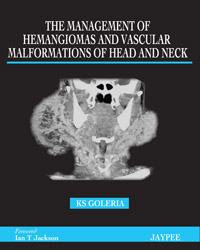 The Management Of Hemangiomas And Vascular Malformations Of Head And ...