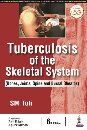 Tuberculosis of the Skeletal System (Bones, Joints, Spine and Bursal Sheaths) by SM Tuli