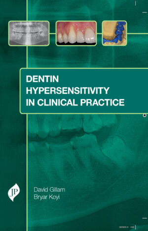 Dentin Hypersensitivity in Clinical Practice by David Gillam