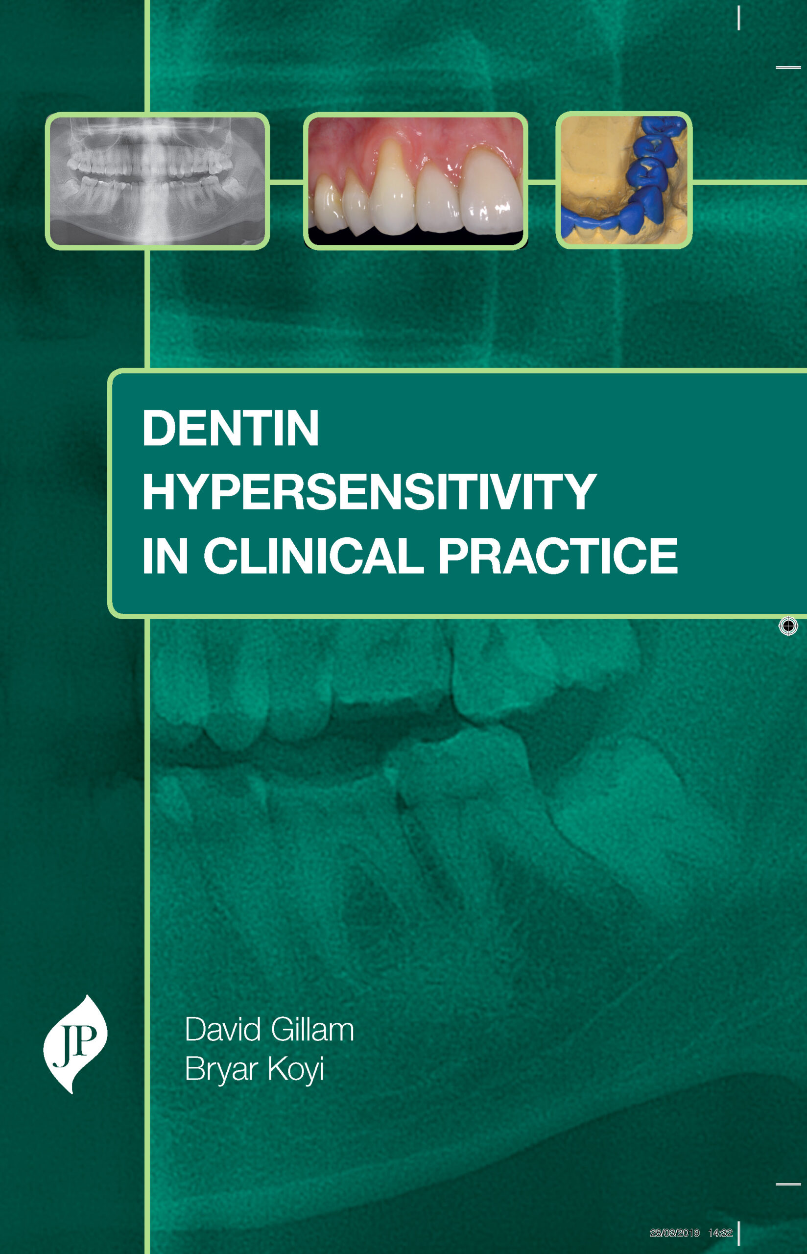 Dentin Hypersensitivity In Clinical Practice By David Gillam   Drcart