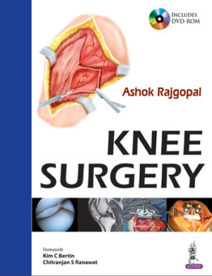 Knee Surgery (with Interactive DVD Rom) by Ashok Rajgopal