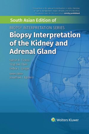 Biopsy Interpretation of the Kidney & Adrenal Gland  by  TICKOO