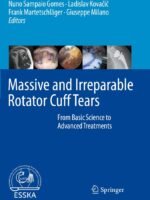 Massive and Irreparable Rotator Cuff Tears: From Basic Science to Advanced Treatments by Frank Martetschlager
