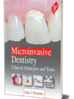 Microinvasive Dentistry: Clinical Strategies and Tools