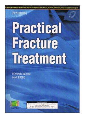 Practical Fracture Treatment by Ronald Mcrae