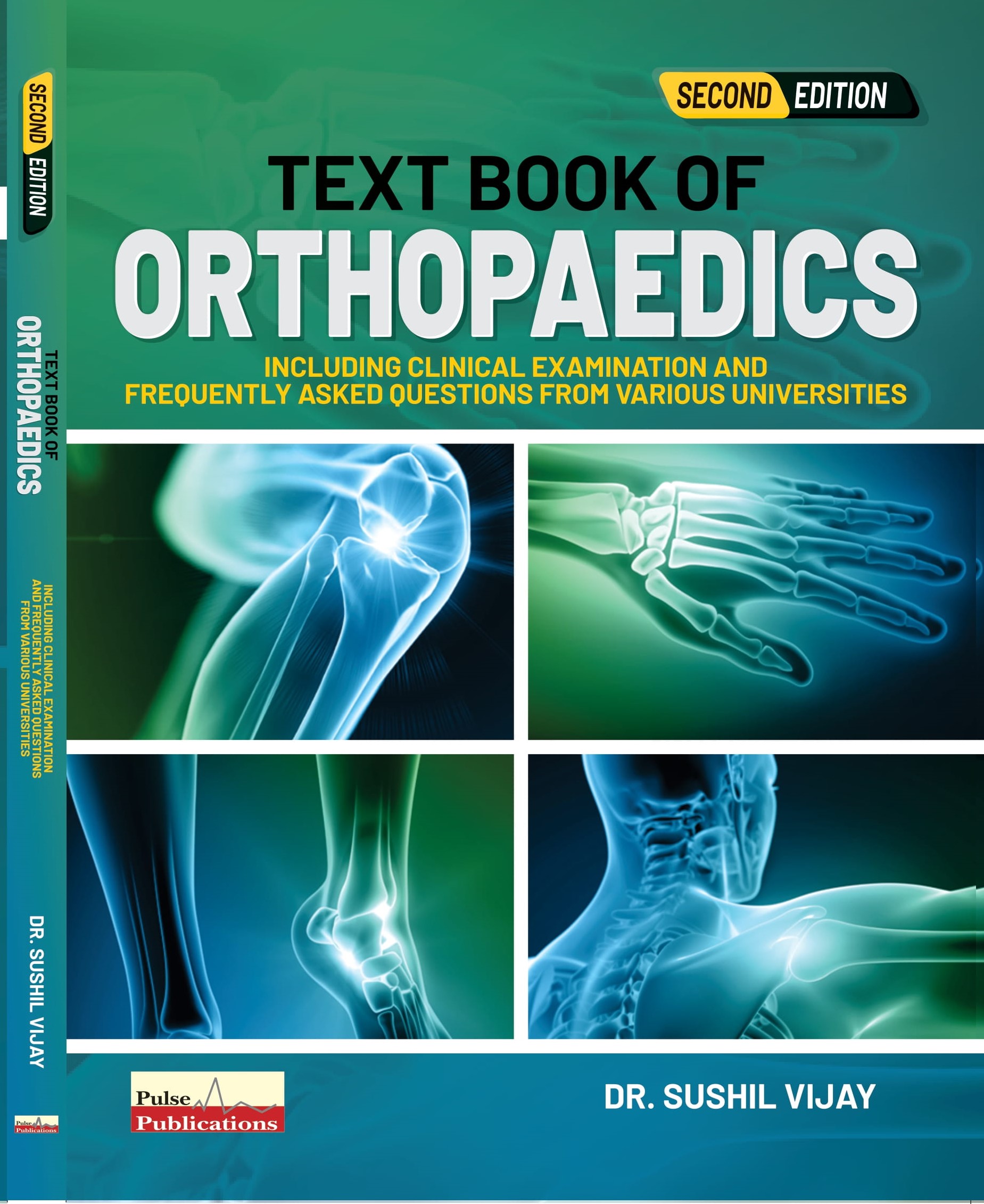 Textbook Of Orthopaedics By Dr. Sushil Vijay - Drcart Textbook Of ...