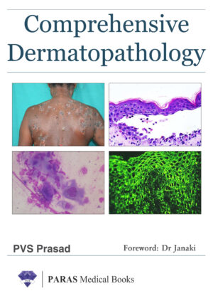 Comprehensive Dermatopathology by PVS Prasad