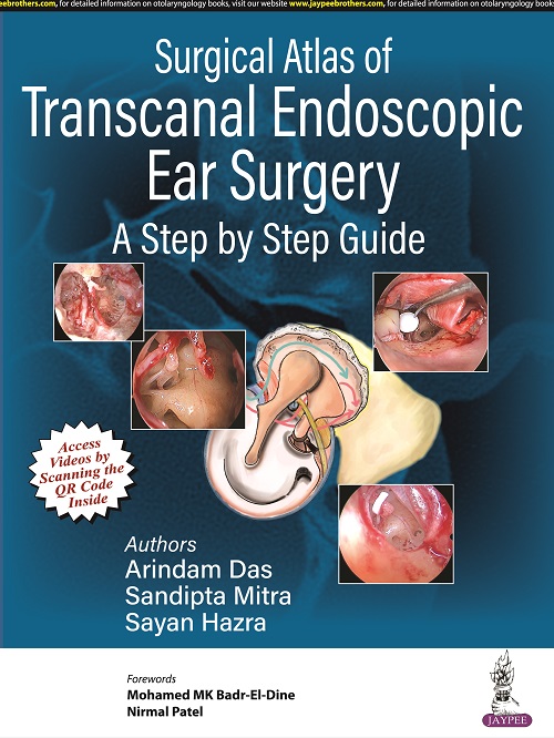 Surgical Atlas of Transcanal Endoscopic Ear Surgery: A Step by Step Guide  by Arindam Das