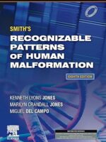 Smith's Recognizable Patterns of Human Malformation: Expert Consult - Online and Print, 8e