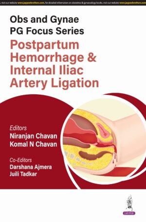 Obs and Gynae PG Focus Series Postpartum Hemorrhage and Internal Iliac Artery Ligation