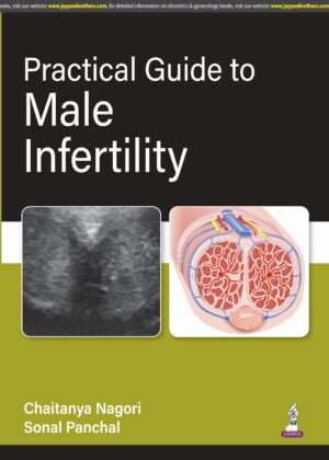 Practical Guide to Male Infertility