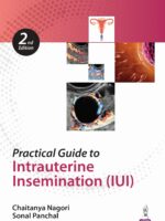 Practical Guide to Intrauterine Insemination