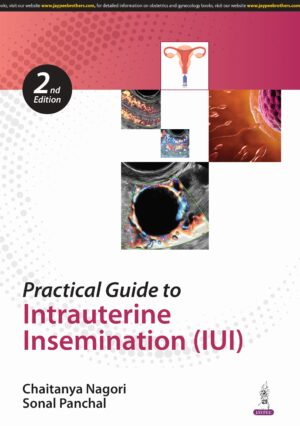 Practical Guide to Intrauterine Insemination