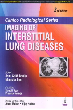 Clinico Radiological Series Imaging of Interstitial Lung Diseases