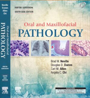 Oral And Maxillofacial Pathology