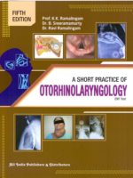 Short Practice of Otorhinolaryngology