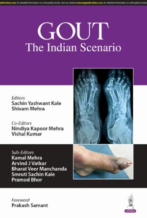 Gout: The Indian Scenario 1st/2025