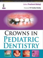 Crowns in Pediatric Dentistry