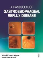 A Handbook of Gastroesophageal Reflux Disease