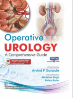Operative Urology: A Comprehensive Guide