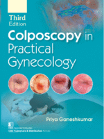 Colposcopy in Practical Gynecology