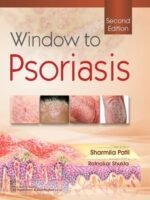 Window to Psoriasis