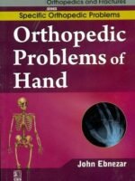 Orthopedic Problems Of Hand (Handbooks In Orthopedics And Fractures Series, Vol.47: Specific Orthopedic Problems)