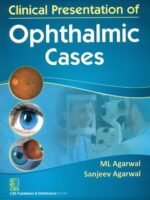 Clinical Presentation Of Opthalmic Cases (Pb2014)
