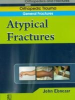 A Typical Fractures (Handbook In Orthopedics And Fractures Vol.4 - Orthopedic Trauma General Fractures)