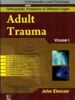 Adult Trauma Vol. 1 (Handbooks In Orthopedics And Fractures Series, Vol. 75 Orthopedic Problems Of Different Ages)