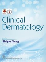 Clinical Dermatology