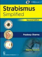 Strabismus—Simplified