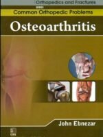 Osteoarthritis (Handbooks In Orthopedics And Fractures Series, Vol. 87 -Common Orthopedic Problems)