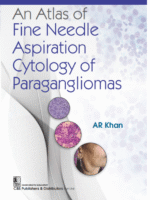 An Atlas of Fine Needle Aspiration Cytology of Paragangliomas