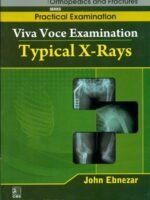 Typical X-Rays (Handbooks In Orthopedics And Fractures Series, Vol. 65-Practical Examination) In Stock
