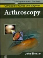 Arthroscopy (Handbooks In Orthopedics And Fractures Series, Vol. 61- Orthopedic Injuries And Surgeries)