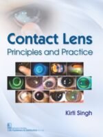 Contact Lens Principles and Practice
