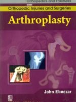 Arthroplasty (Handbooks In Orthopedics And Fractures Series, Vol. 62 -Orthopedic Injuries And Surgeries)