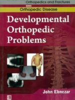 Developmental Orthopedic Problems (Handbooks In Orthopedics And Fractures Series, Vol. 29: Orthopedic Disease)
