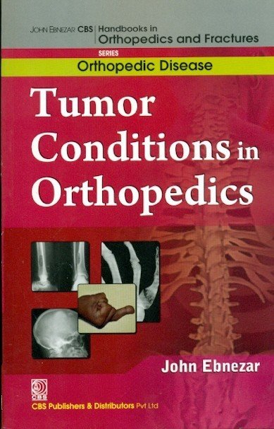 Tumor Conditions In Orthopedics (Handbooks In Orthopedics And Fractures Series, Vol. 36: Orthopedic Disease)